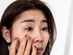 Safe And Soothing Eye Infection Remedies For All Ages
