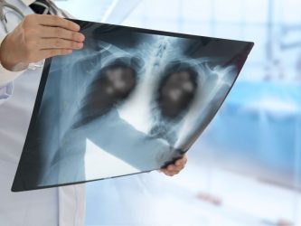 pneumonia-care-niagara-falls Urgent Care X-ray Services