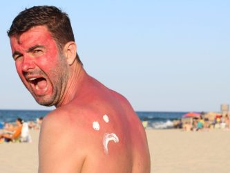 How To Treat Sunburn Naturally
